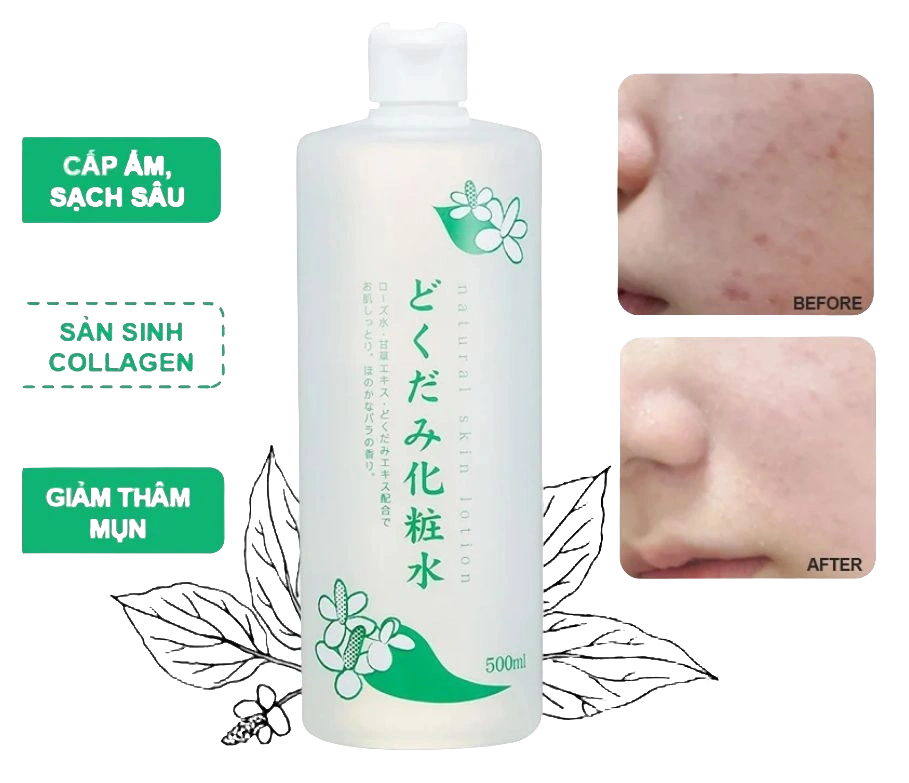 Toner/Nước hoa hồng DIẾP CÁ 500ml Nhật Bản (24/th)