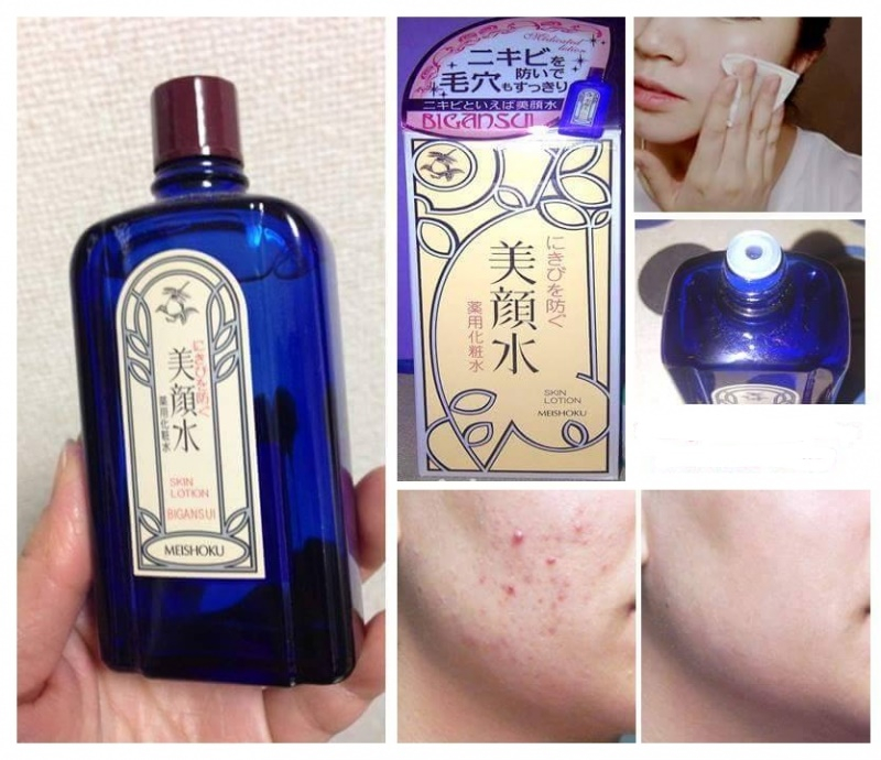 Nước hoa hồng/toner trị mụn Meishoku Bigansui Medicated Skin Lotion 90ml Nhật Bản(36/th)