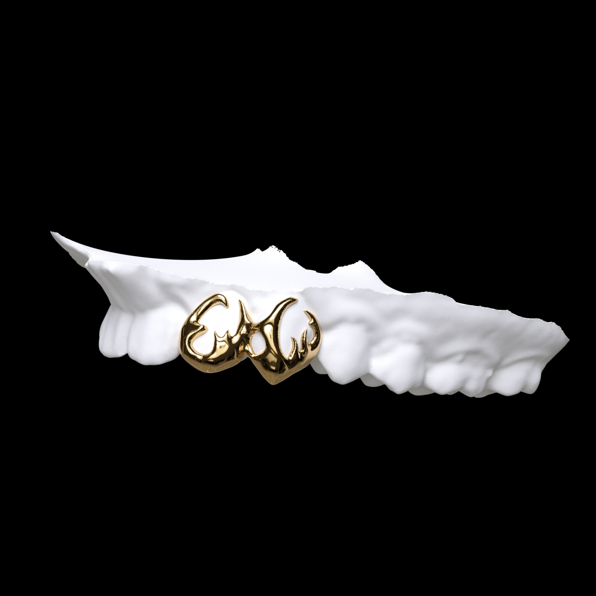 Custom Grillz 34 10k