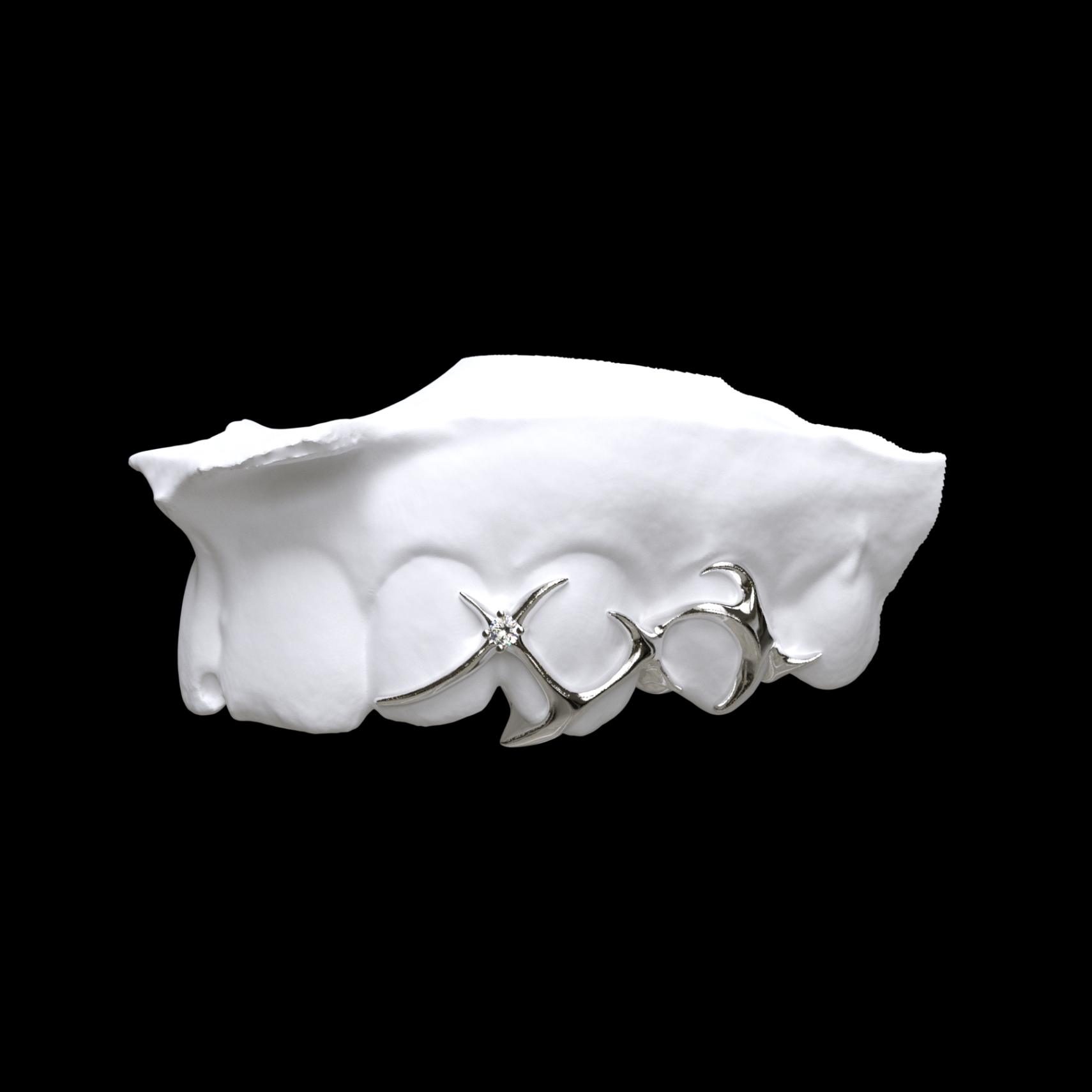 Custom grillz 78