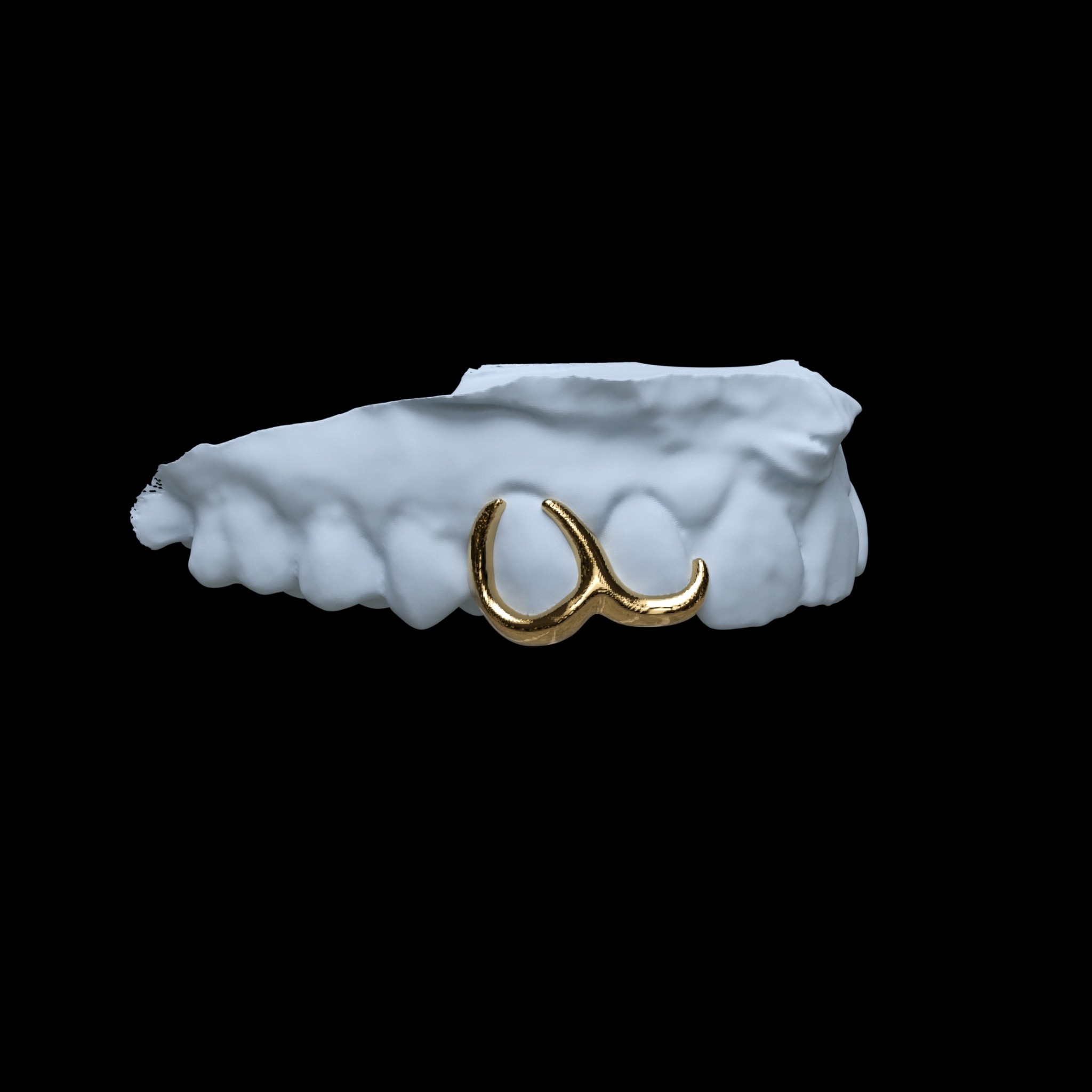 Custom Grillz 32
