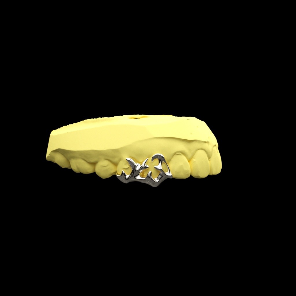 Custom Grillz 14