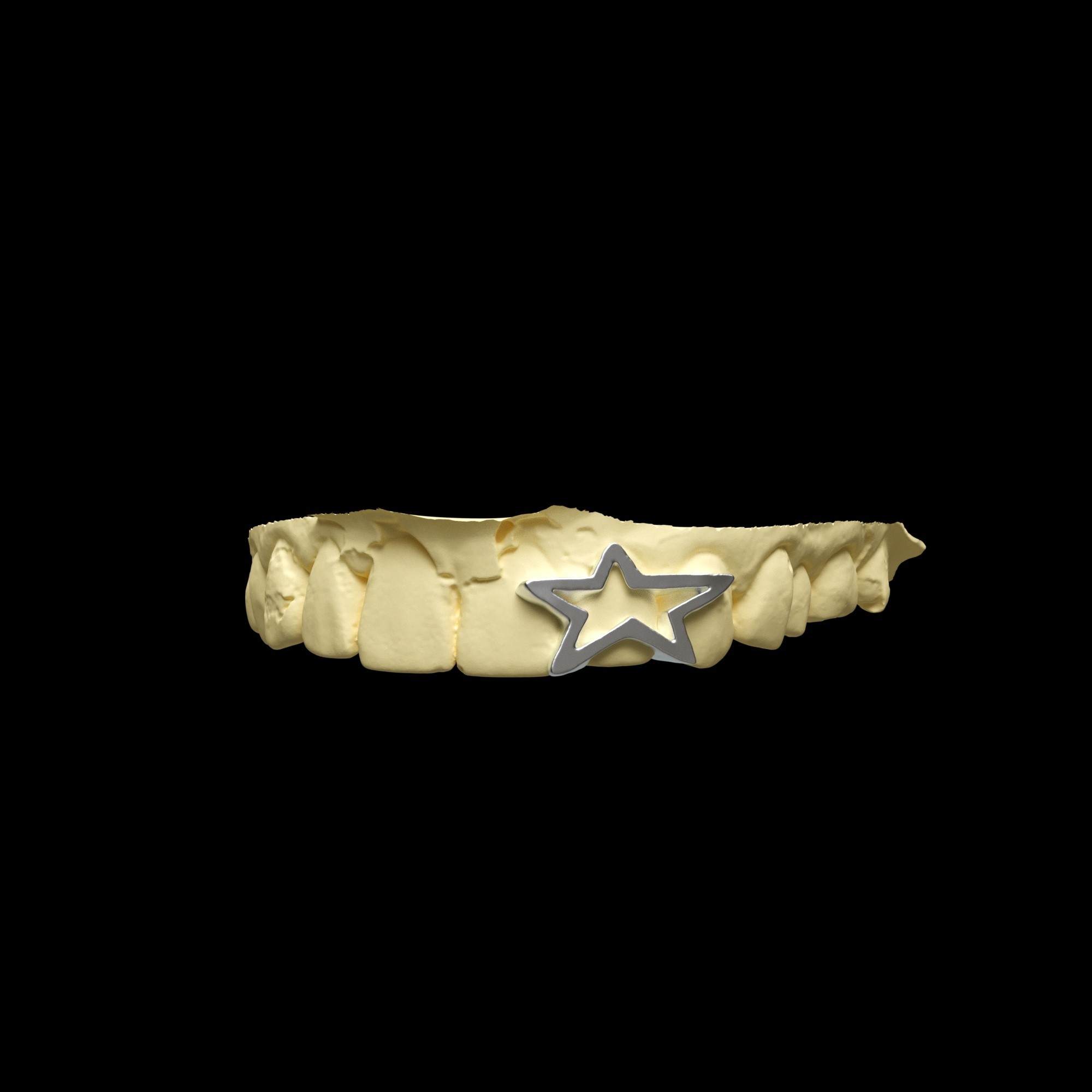 Custom Grillz