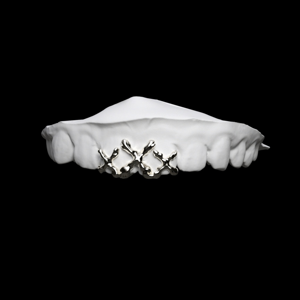 Custom Grillz 6
