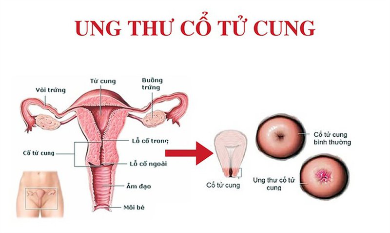 Giat-minh-12-benh-phu-khoa-pho-bien-o-phu-nu-ban-co-the-da-mac-ma-khong-biet--3.jpg