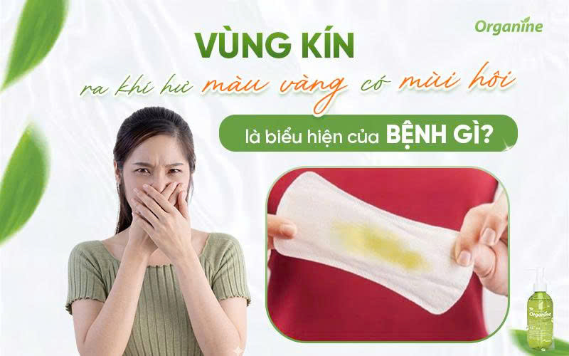 Vùng kín ra khí hư màu vàng có mùi hôi là biểu hiện của bệnh gì?