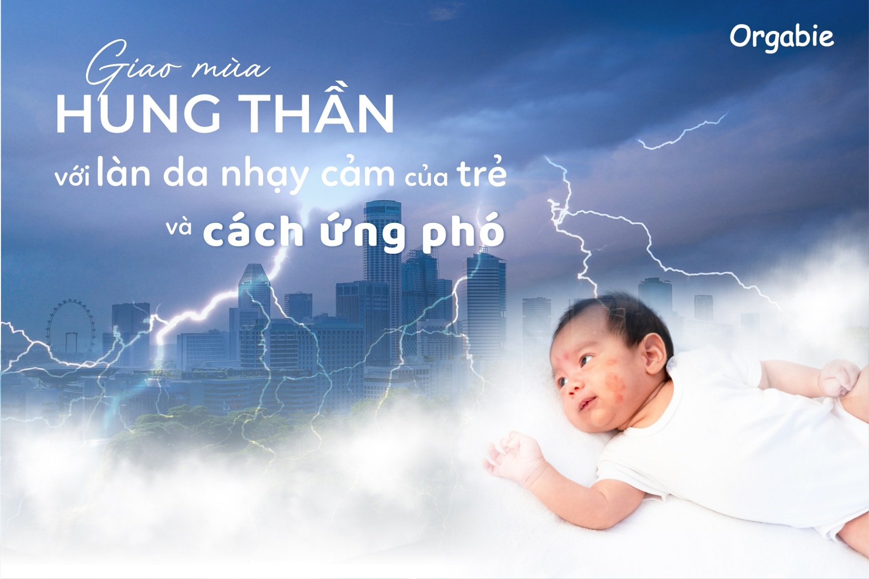 Giao mùa - hung thần với làn da nhạy cảm của trẻ và cách ứng phó