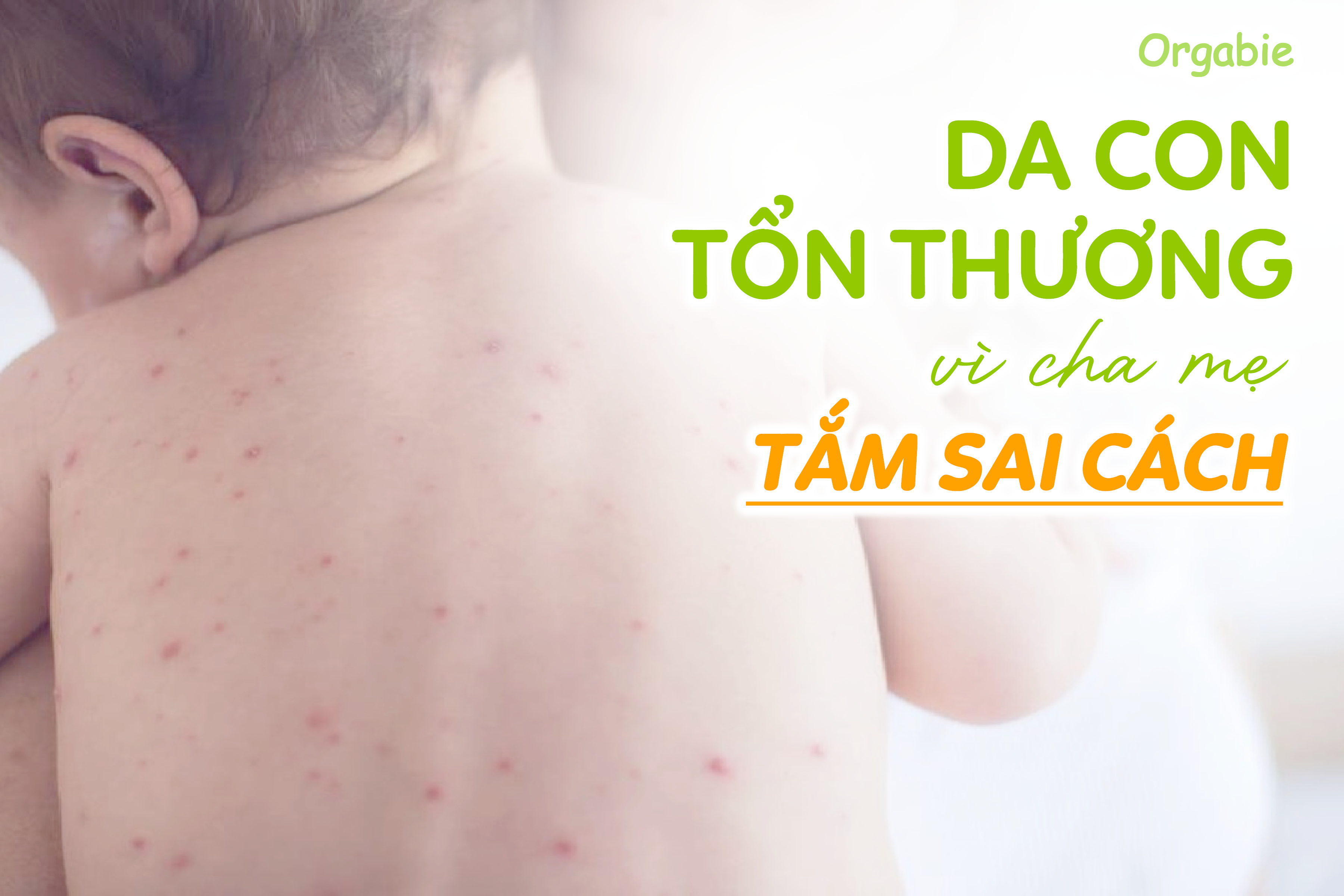 6-sai-lam-khi-tam-cho-tre-khien-da-be-ton-thuong-nghiem-trong-5.png