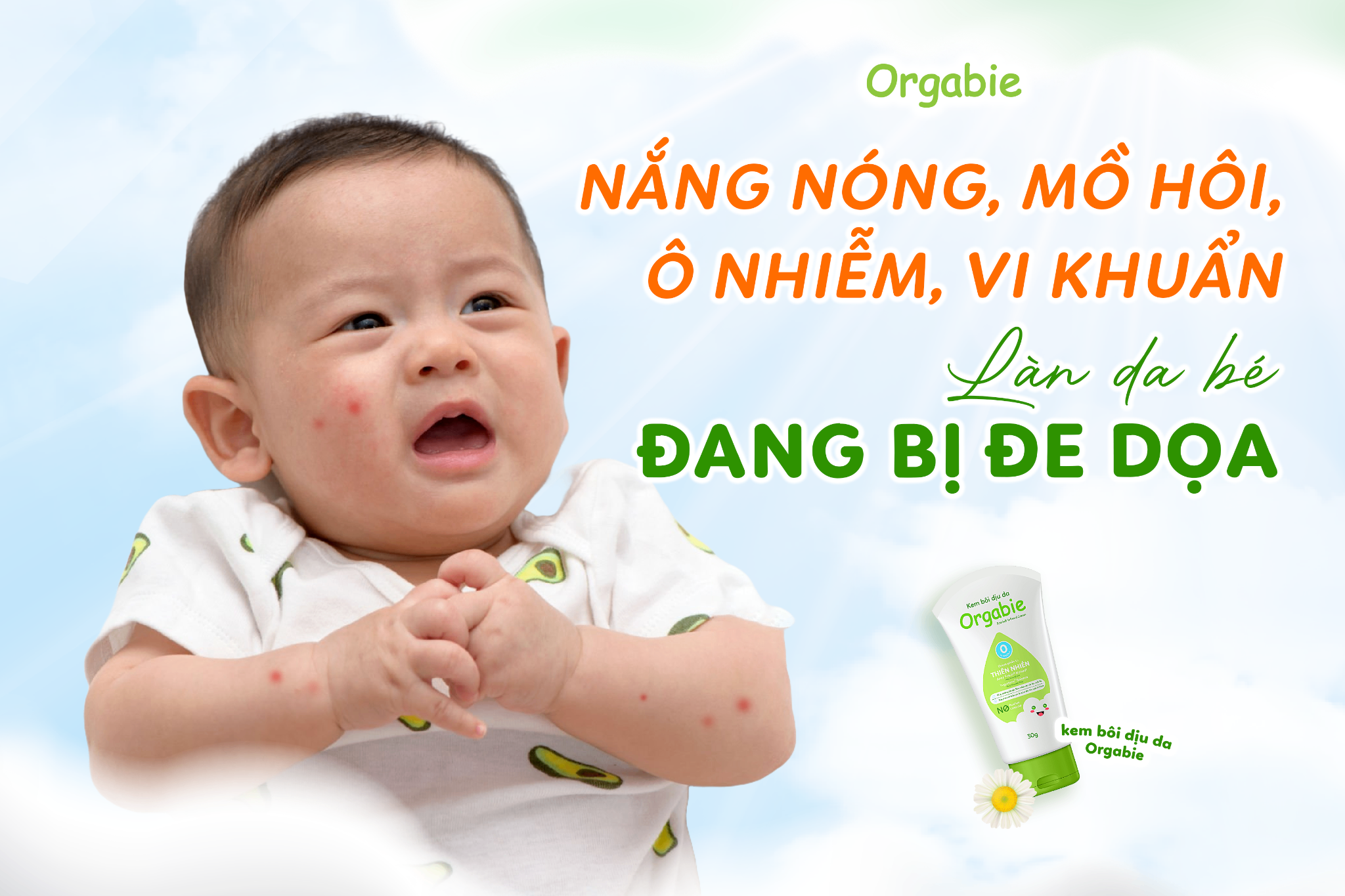 Bí quyết bảo vệ làn da trẻ khỏi rôm sảy, hăm tã mùa hè