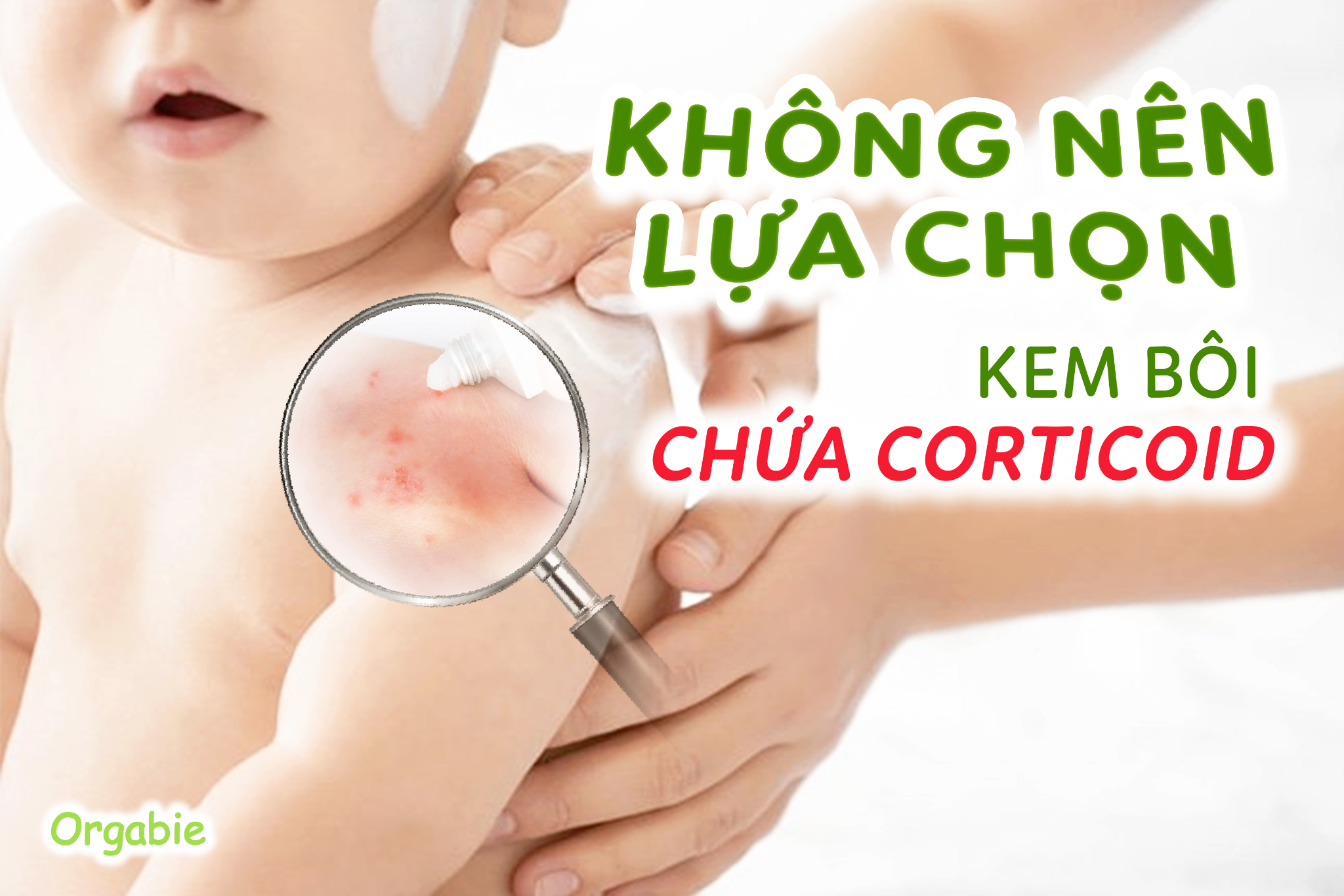 Không nên dùng kem chứa corticoid cho trẻ sơ sinh