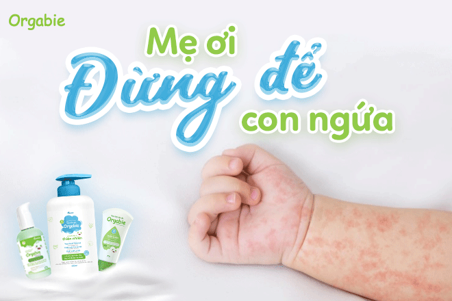 Mẹ nên chú ý những vùng da dễ nổi mẩn, hăm đỏ