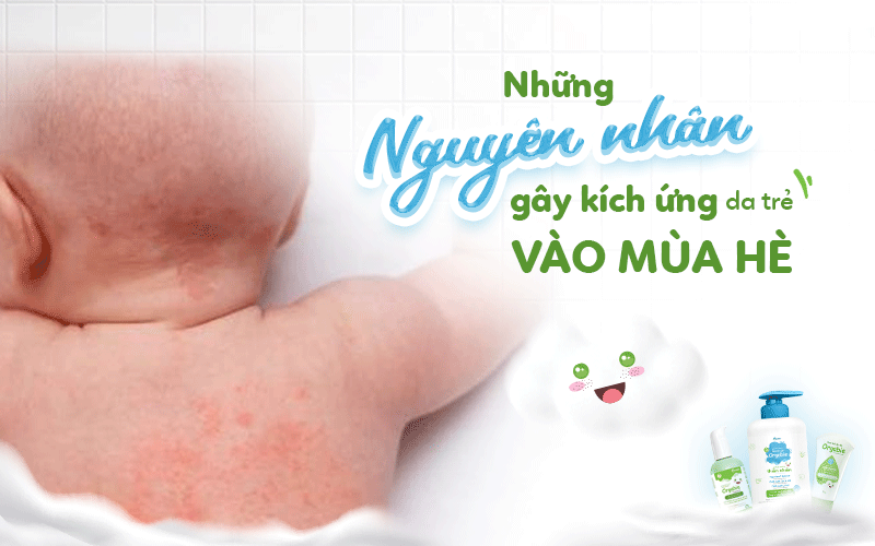 Những nguyên nhân gây kích ứng da trẻ vào mùa hè: Cha mẹ chớ lơ là!