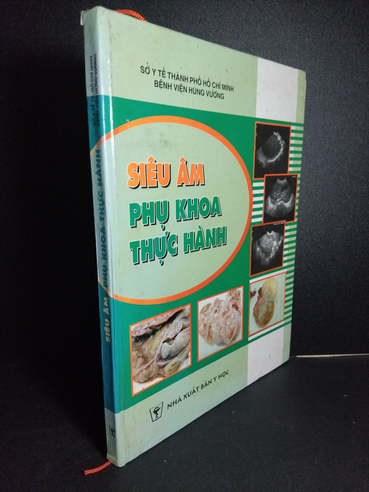 Siểu âm phụ khoa thực hành (bìa cứng) mới 80% ố bong gáy có chữ ký ở cuối sách 2008 1001 Sách chuyên môn (SL có thể đặt: 1 Cuốn) - SÁCH ĐẠI HỌC