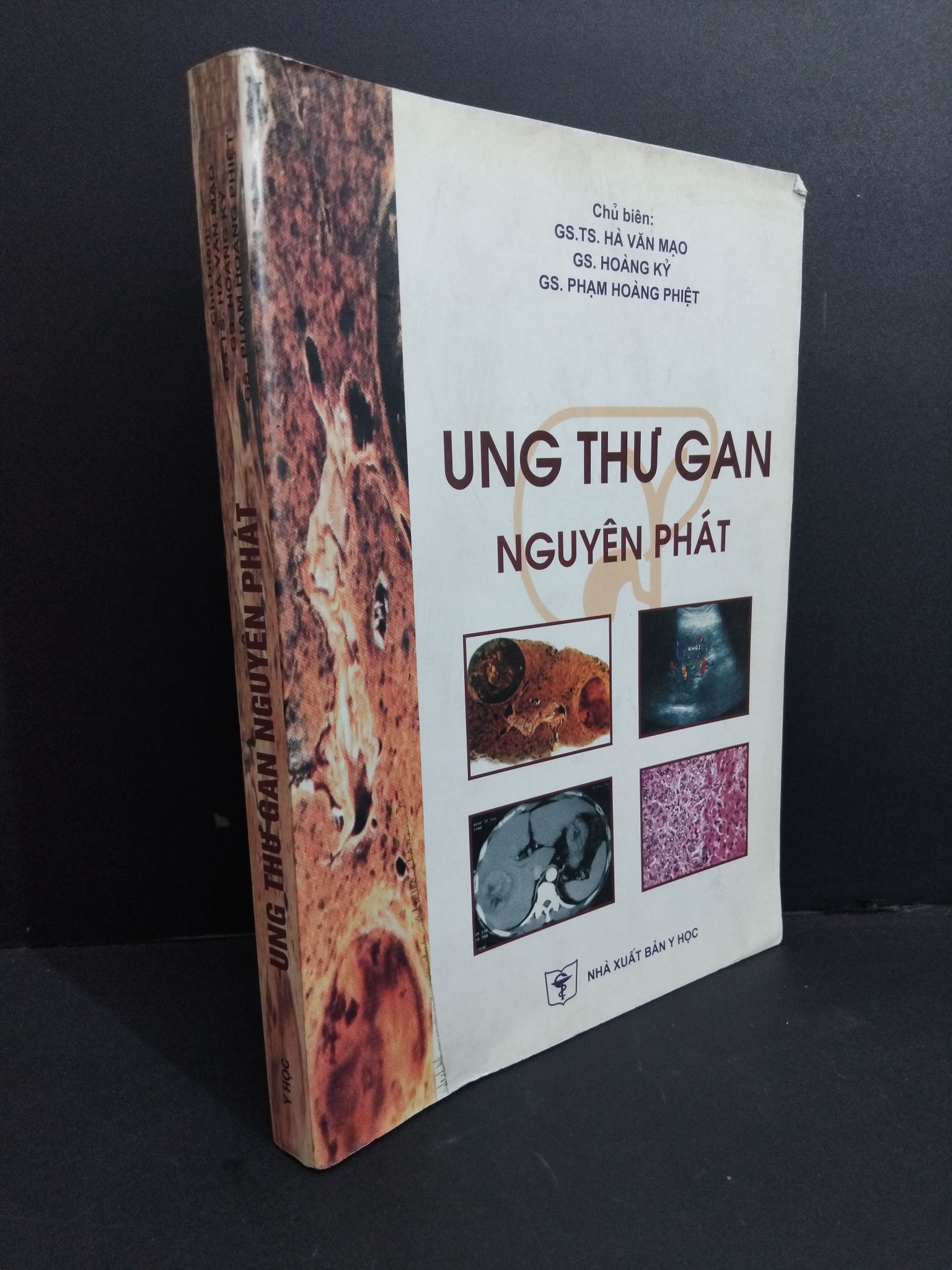 Ung thư gan nguyên phát mới 80% ố bẩn bìa 2006 2811 Sách chuyên môn (SL có thể đặt: 1 Cuốn) - SÁCH ĐẠI HỌC