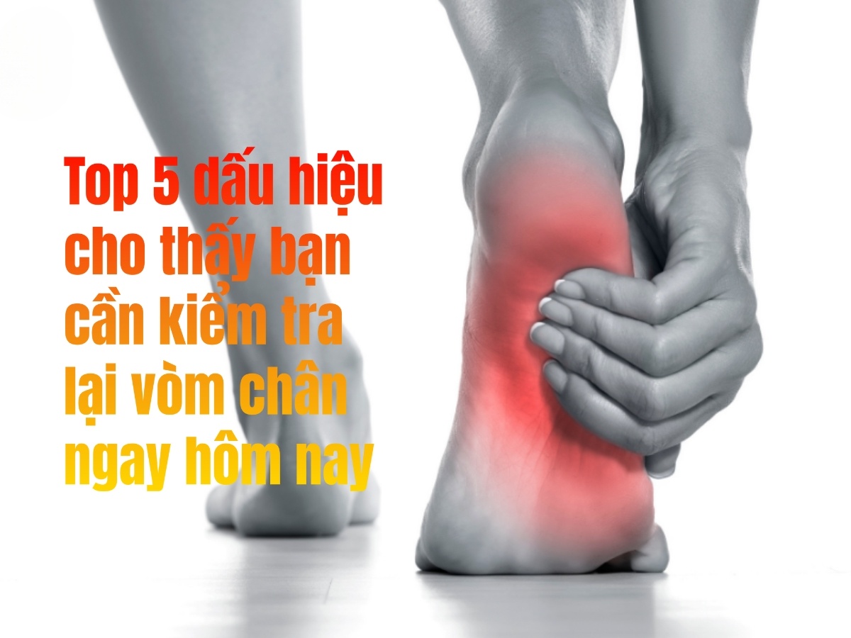 Top 5 dấu hiệu cho thấy bạn cần kiểm tra lại vòm chân ngay hôm nay