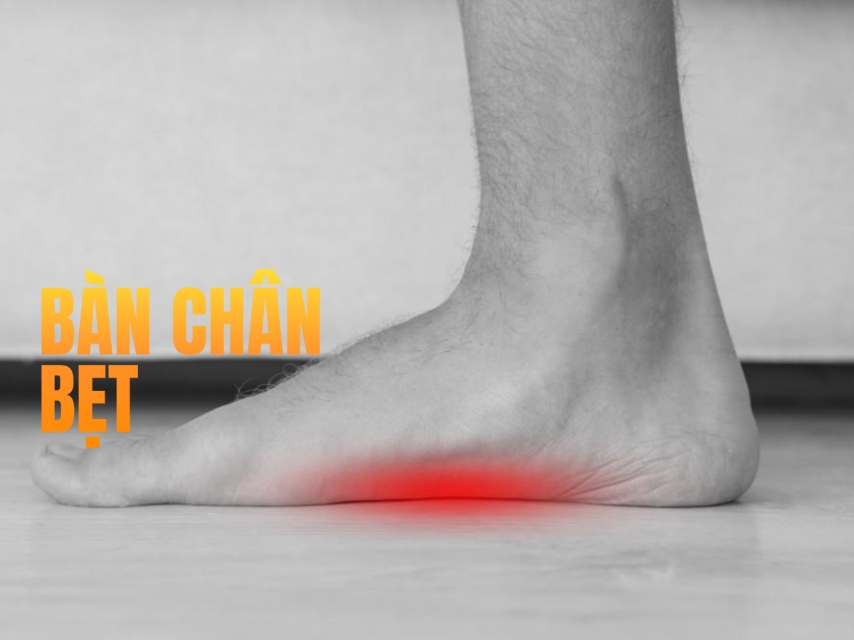 Lót giày thể thao cho bàn chân bẹt (Chân Low Arch)