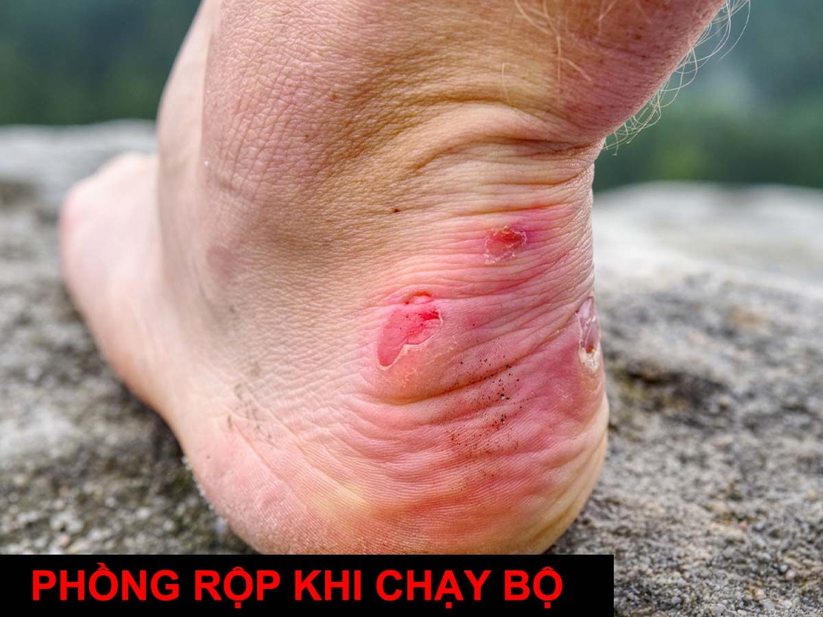 Đây là bài viết mẫu