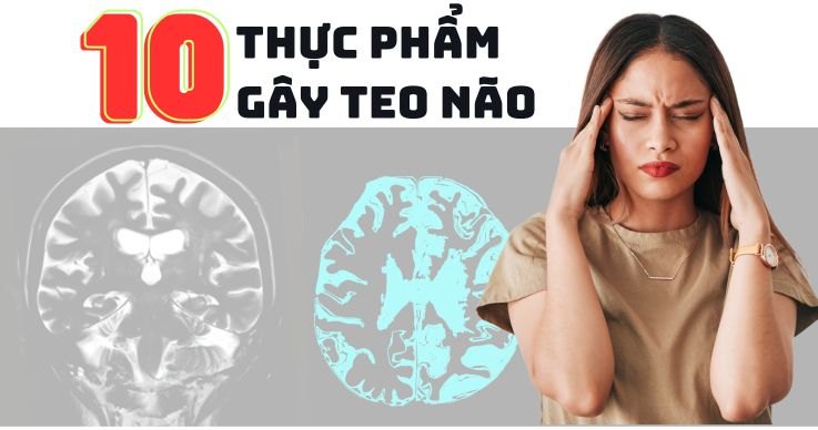 10 Thực Phẩm Gây Teo Não: Cẩn Trọng Kẻo Mất Trí Nhớ Sớm