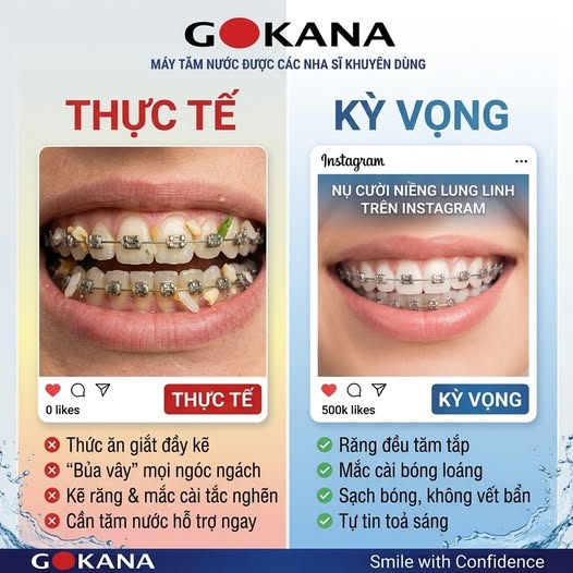 THỨC ĂN DÍNH VÀO VÀO MẮC CÀI - NỖI ÁM ẢNH CỦA ANH CHỊ EM NIỀNG RĂNG!