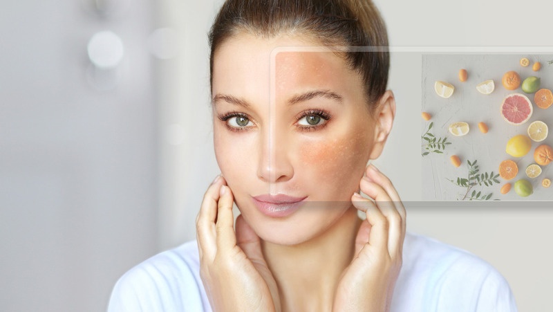 5 nhóm thực phẩm khiến da dễ nổi mụn và xỉn màu