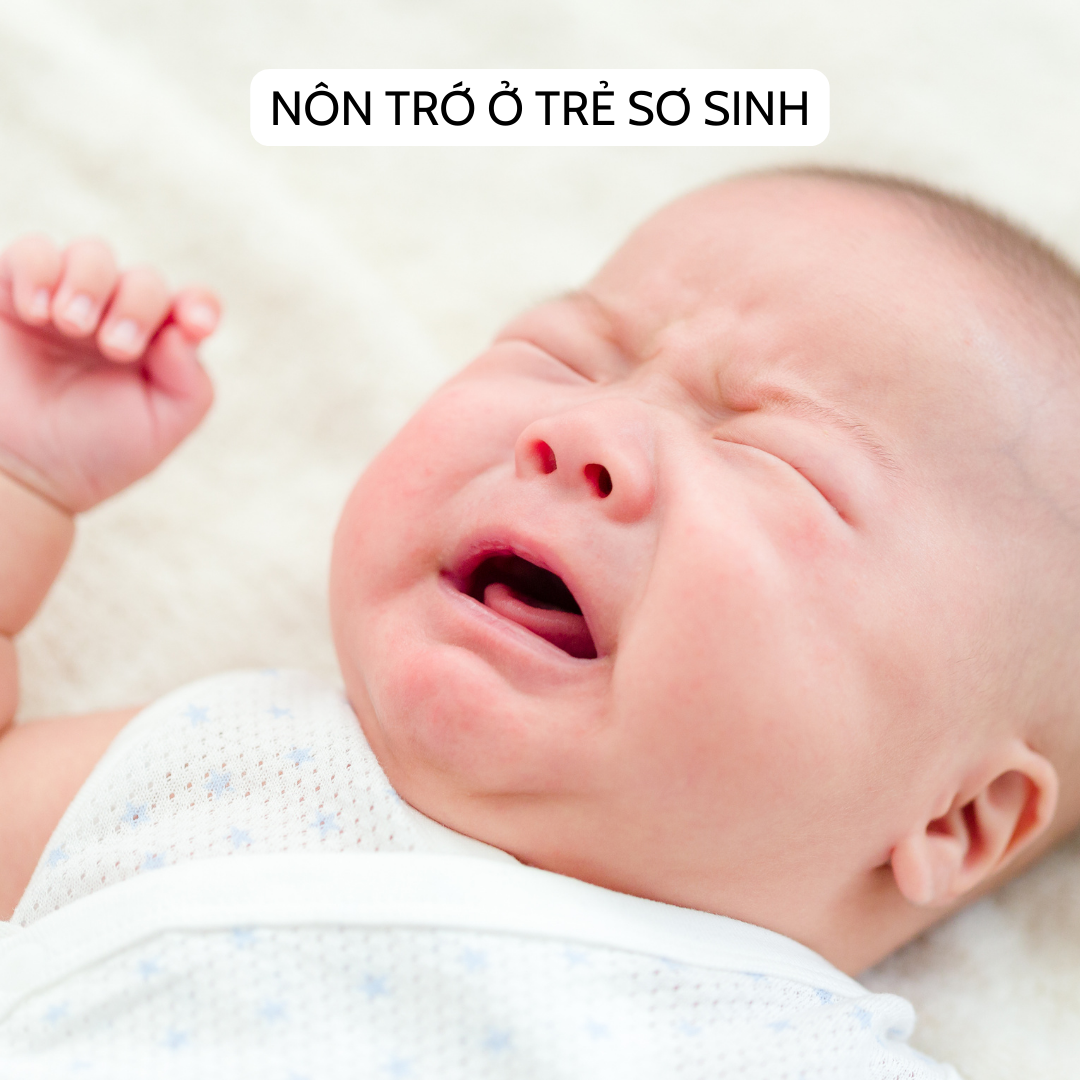 Nôn trớ ở trẻ sơ sinh