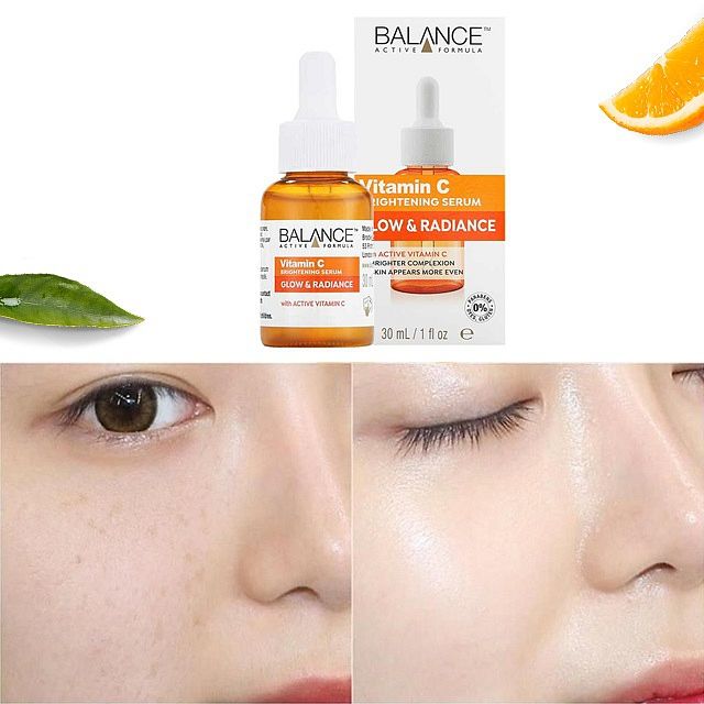 Tinh Chất Làm Sáng Da, Mờ Thâm Balance Serum Vitamin C 30ml