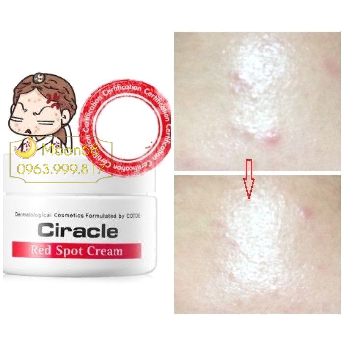 Kem trị mụn Ciracle Red Spot Cream trị thâm 30g