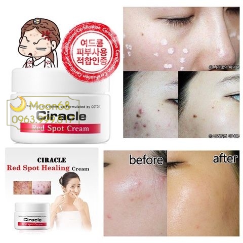 Kem trị mụn Ciracle Red Spot Cream trị thâm 30g