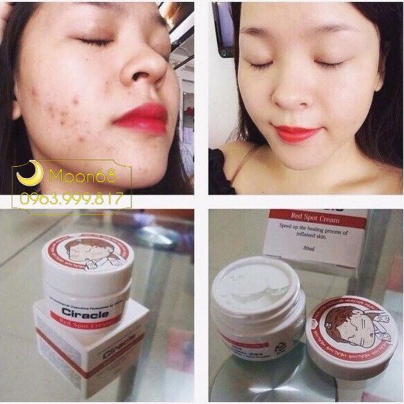 Kem trị mụn Ciracle Red Spot Cream trị thâm 30g