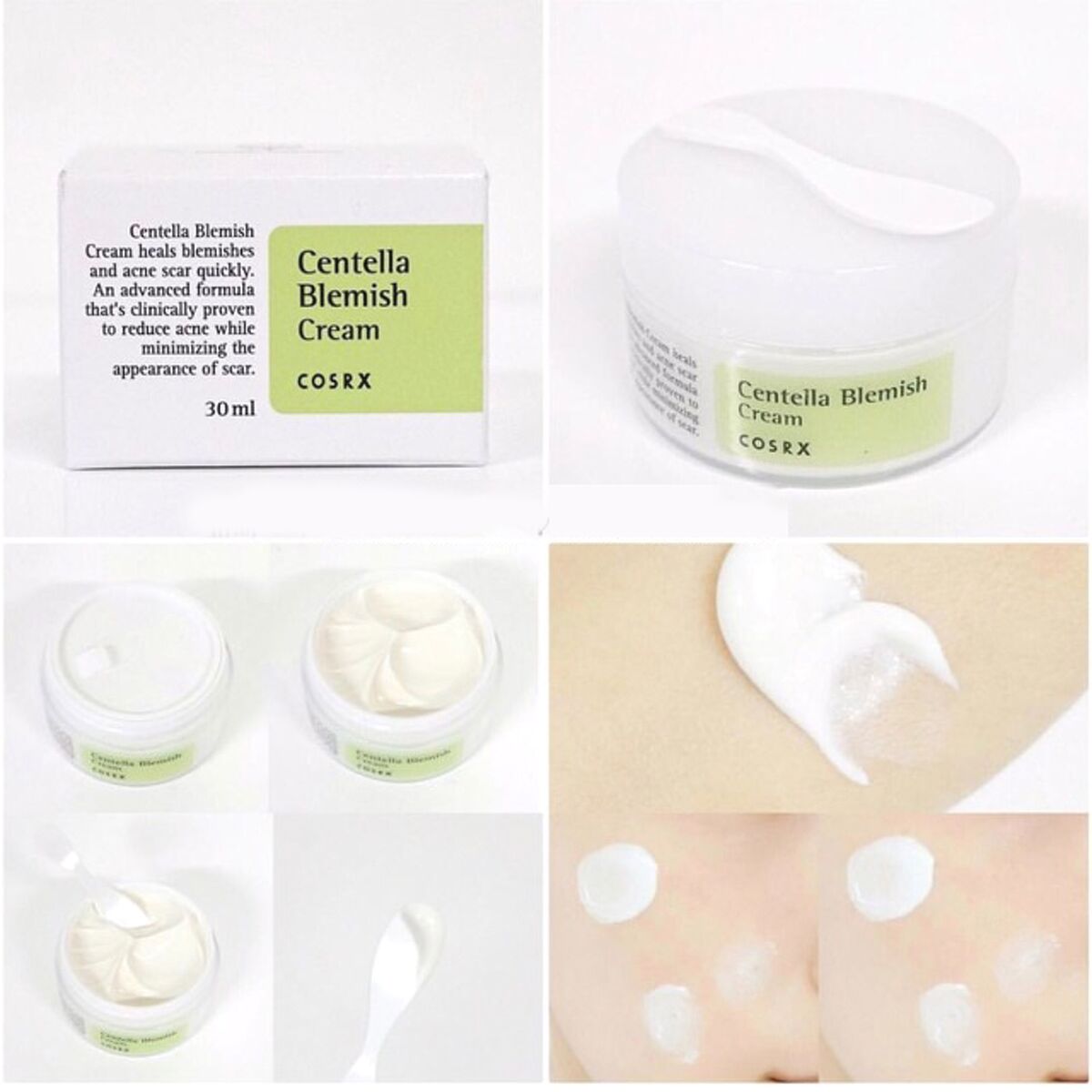 Kem dưỡng Cosrx Centella Blemish Cream trị mụn 30g 1t72