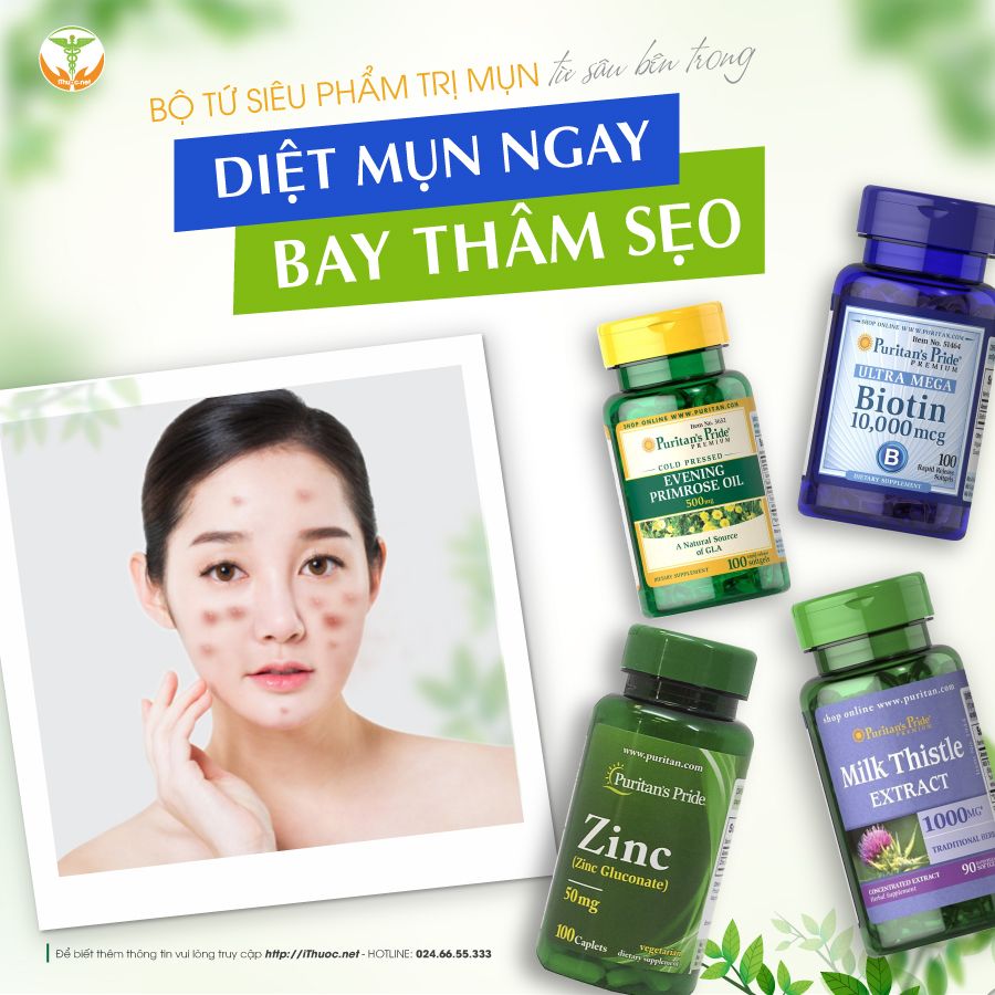 Bộ tứ hỗ trợ mụn