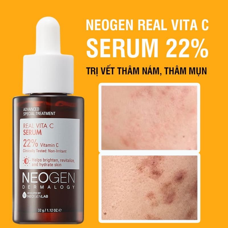 Tinh chất Neogen Vita C Serum 22% dưỡng trắng, trị thâm nám