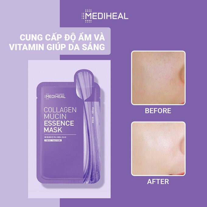 MẶT NẠ MEDIHEAL DẠNG TÚI 15 MIẾNG