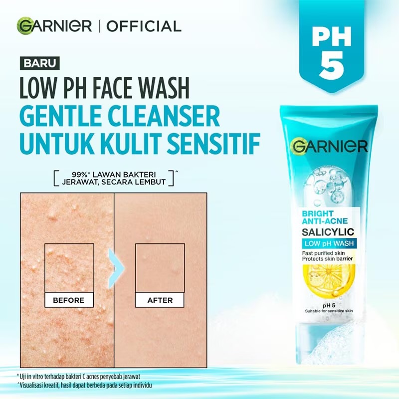 Sữa Rửa Mặt Garnier Bright Anti-Acne Salicylic Low pH Wash 100ml - Vỏ Xanh