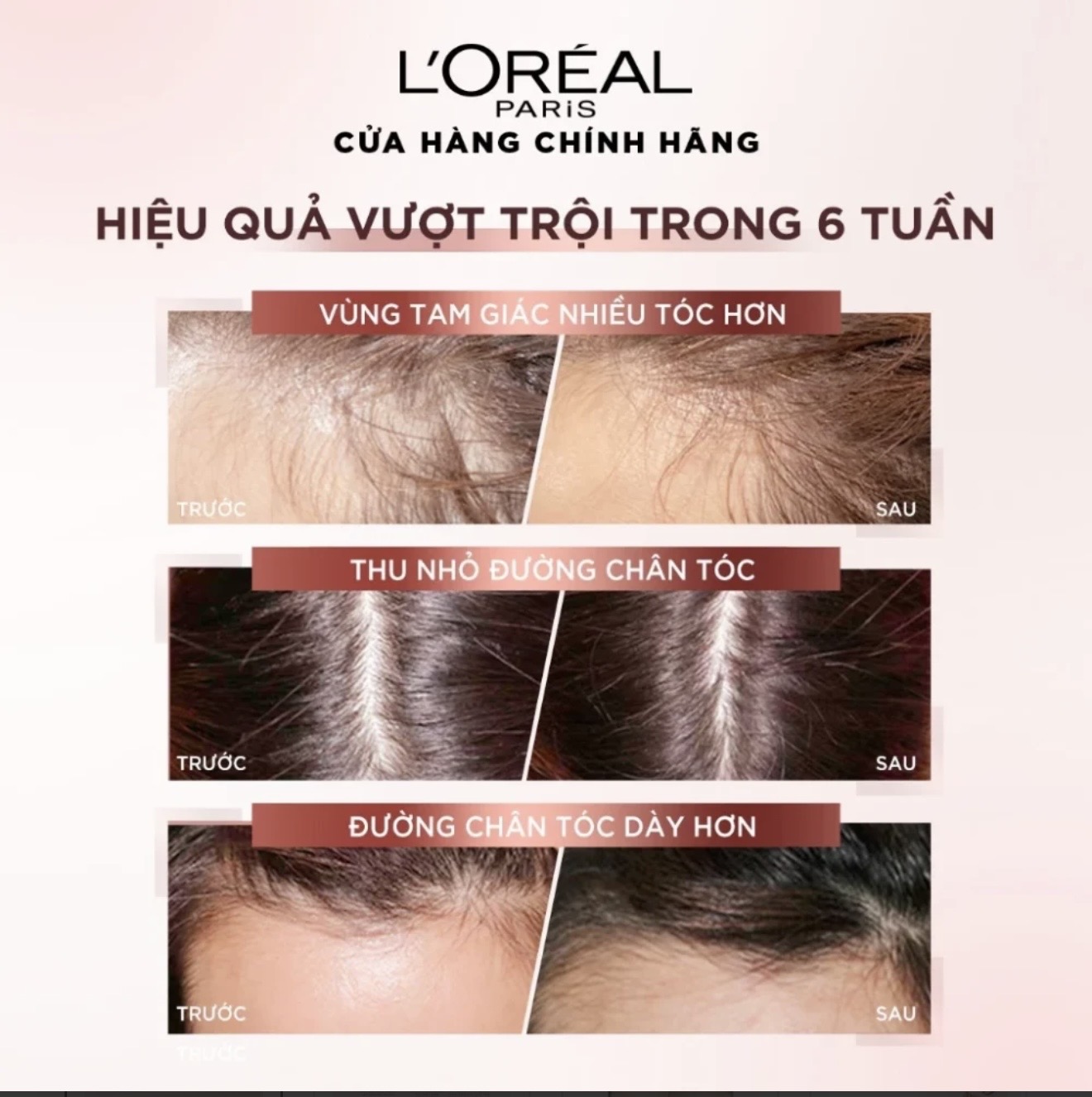 Xịt Dưỡng Tóc L'Oreal Paris Full Resist Anti Hair Fall 90ml