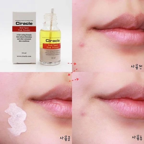 Dung dịch chấm mụn Ciracle Red Spot Pink mới