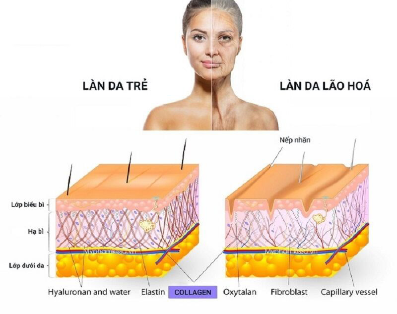 Làn da trẻ dần lão hoá do thiếu Collagen