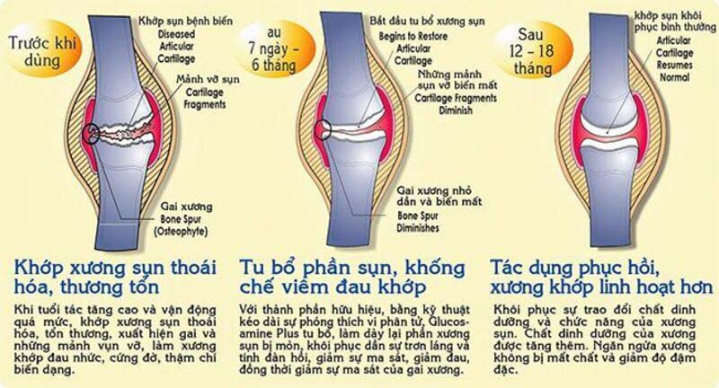 Lợi ích chính của Glucosamine