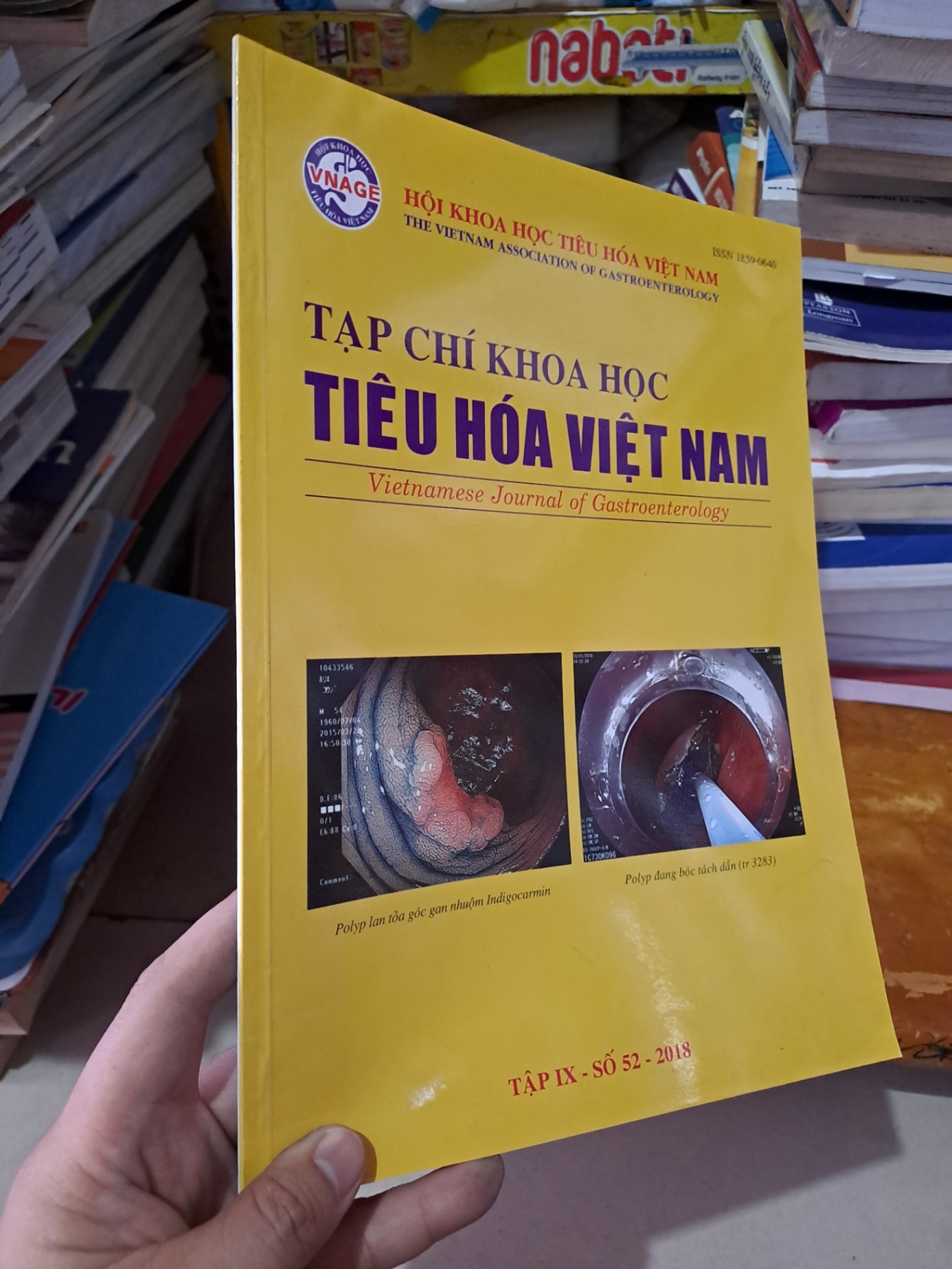 Tạp chí khoa học tiêu hóa việt nam số 52 mới 90% 2018 HCM0808 TẠP CHÍ, THIẾT KẾ, THỜI TRANG