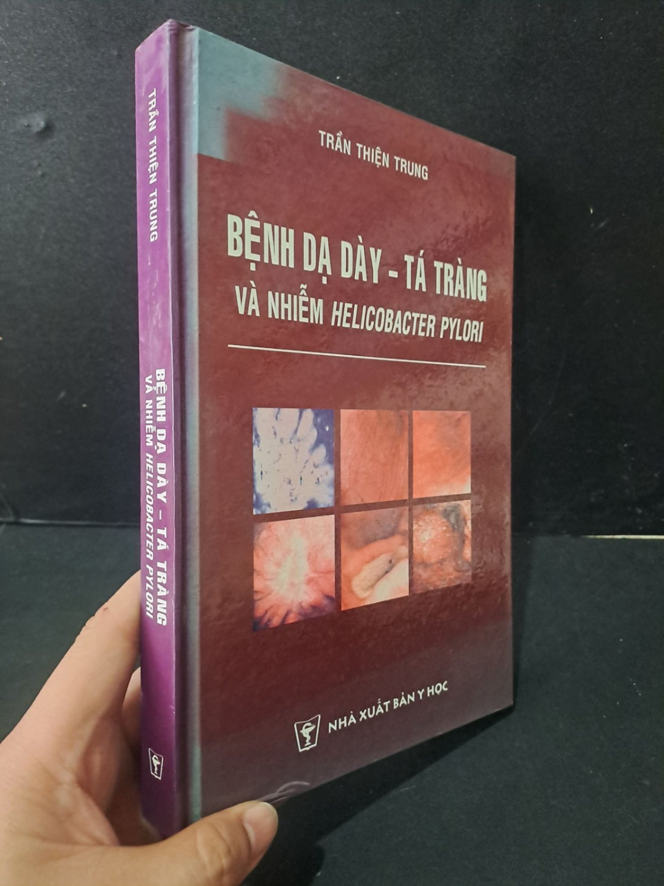 Bệnh dạ dày - tá tràng và nhiễm Helicobacter Pylori (bìa cứng) mới 80% bẩn nhẹ 2008 Trần Thiện Trung HCM1604 SỨC KHỎE - THỂ THAO (NSX)