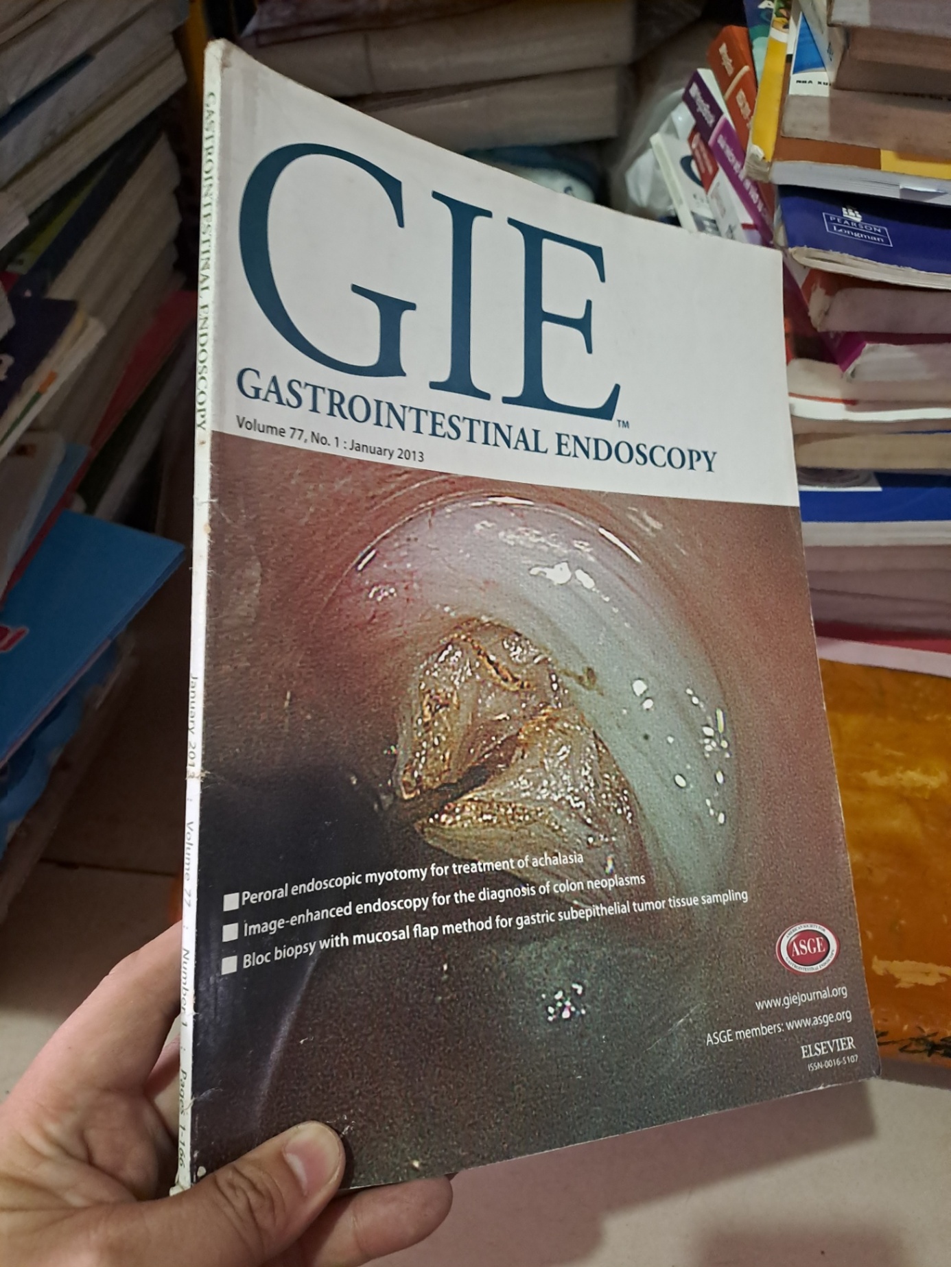 GIE Gastrointestinal Endoscopy volume 77 no 1 1/2013 HCM0808 TẠP CHÍ, THIẾT KẾ, THỜI TRANG