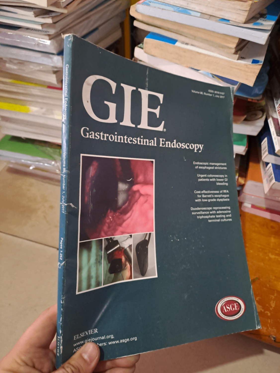 GIE Gastrointestinal Endoscopy volume 86 no 1 7/2017 HCM0808 TẠP CHÍ, THIẾT KẾ, THỜI TRANG