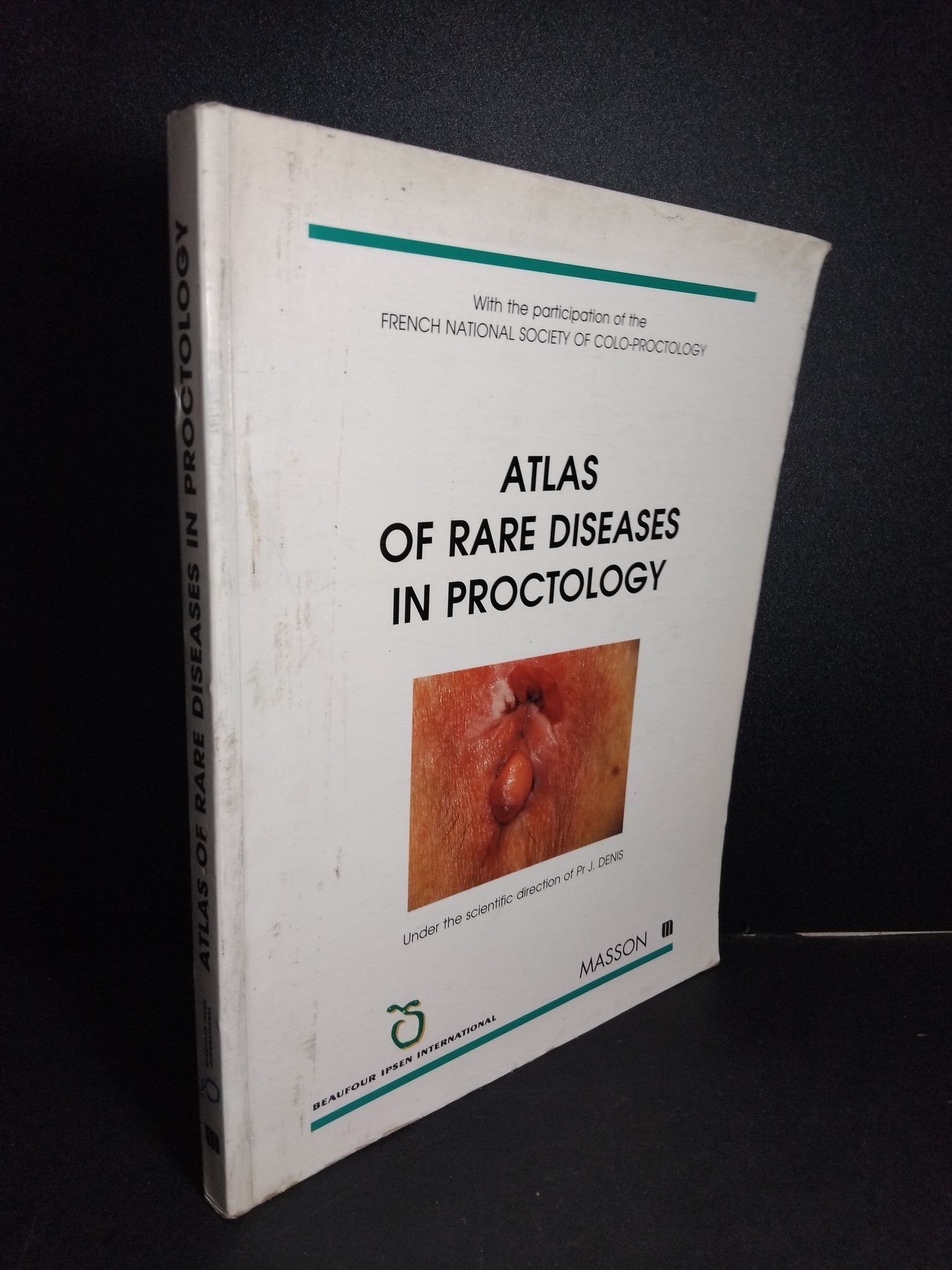 Atlas of rare diseases in proctology (sách màu) mới 80% bẩn bìa, ố nhẹ HCM2101 NGOẠI VĂN