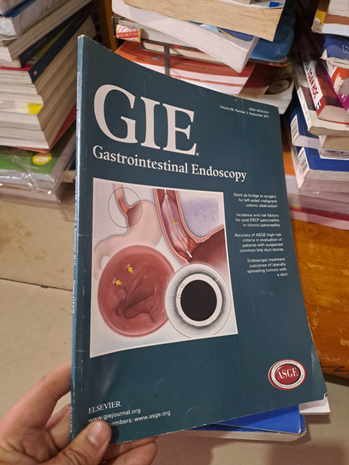 GIE Gastrointestinal Endoscopy volume 86 no 3 9/2017 HCM0808 TẠP CHÍ, THIẾT KẾ, THỜI TRANG