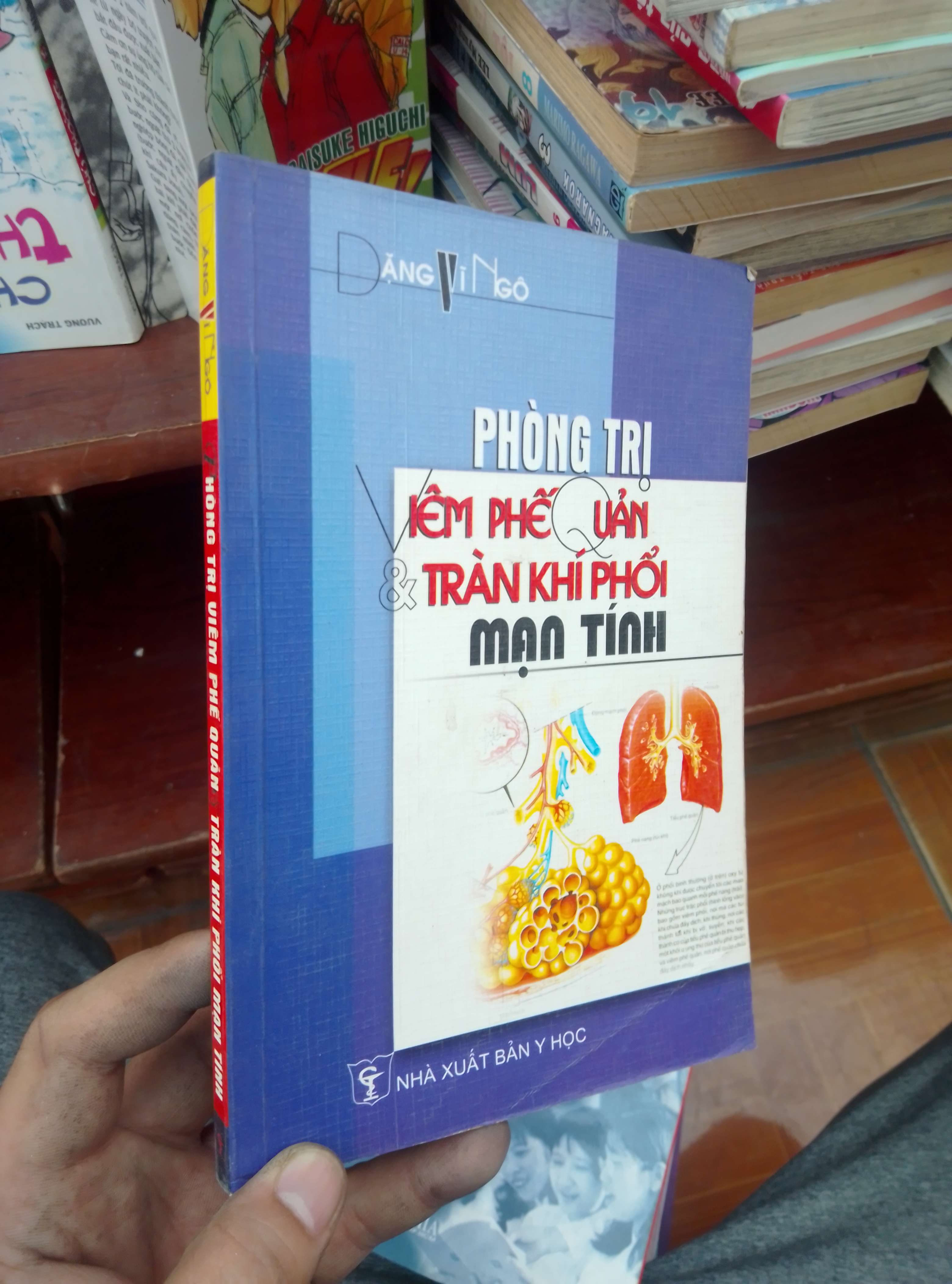 Phòng trị viêm phế quản và tràn khí phổi mạn tính - Vĩ Ngô 2004 Sách Y học - Sức khỏe - Thể thao VAVO-AK19