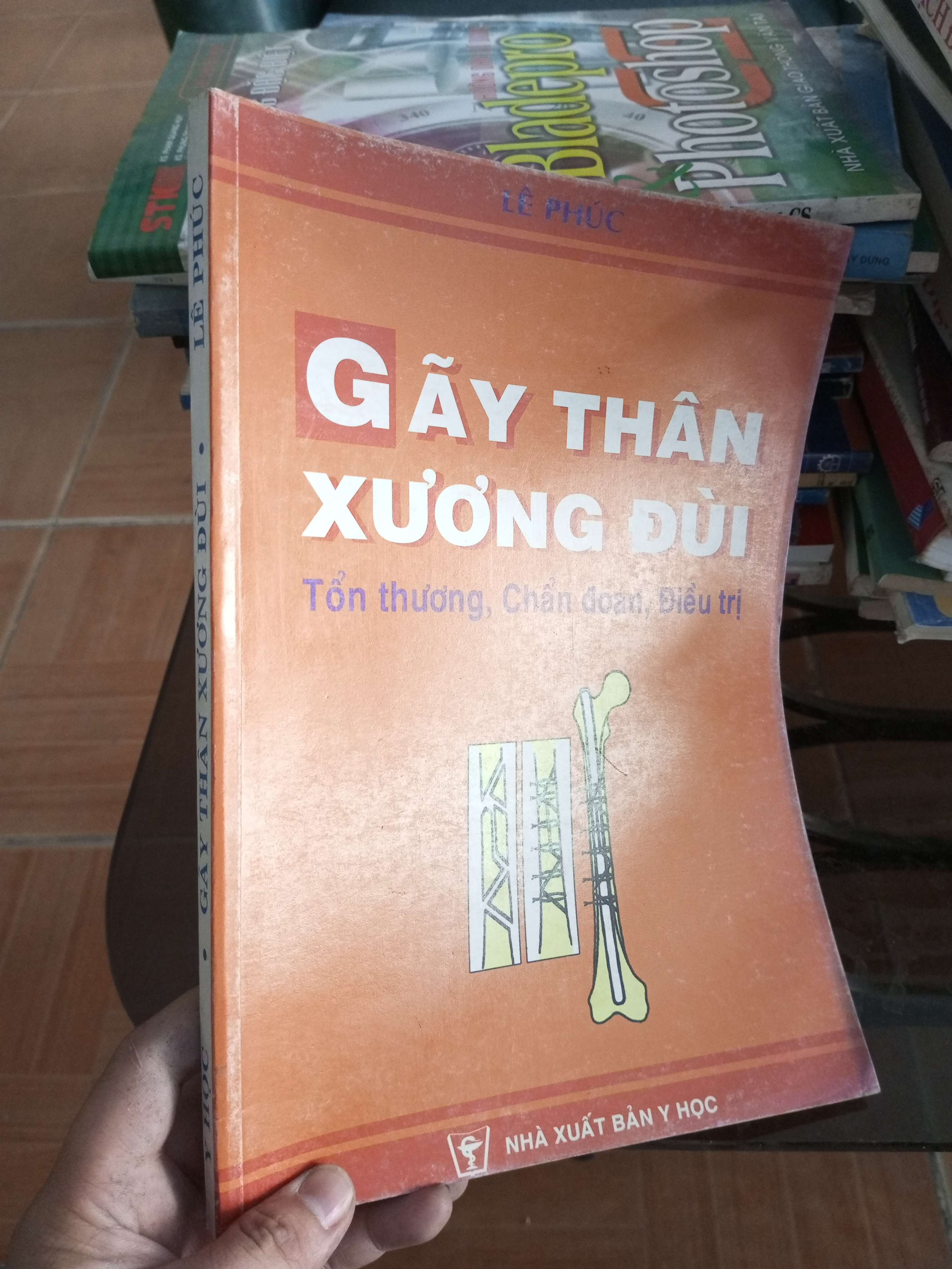 Gãy thân xương đùi - Lê Phúc 2002 VAVO-A2