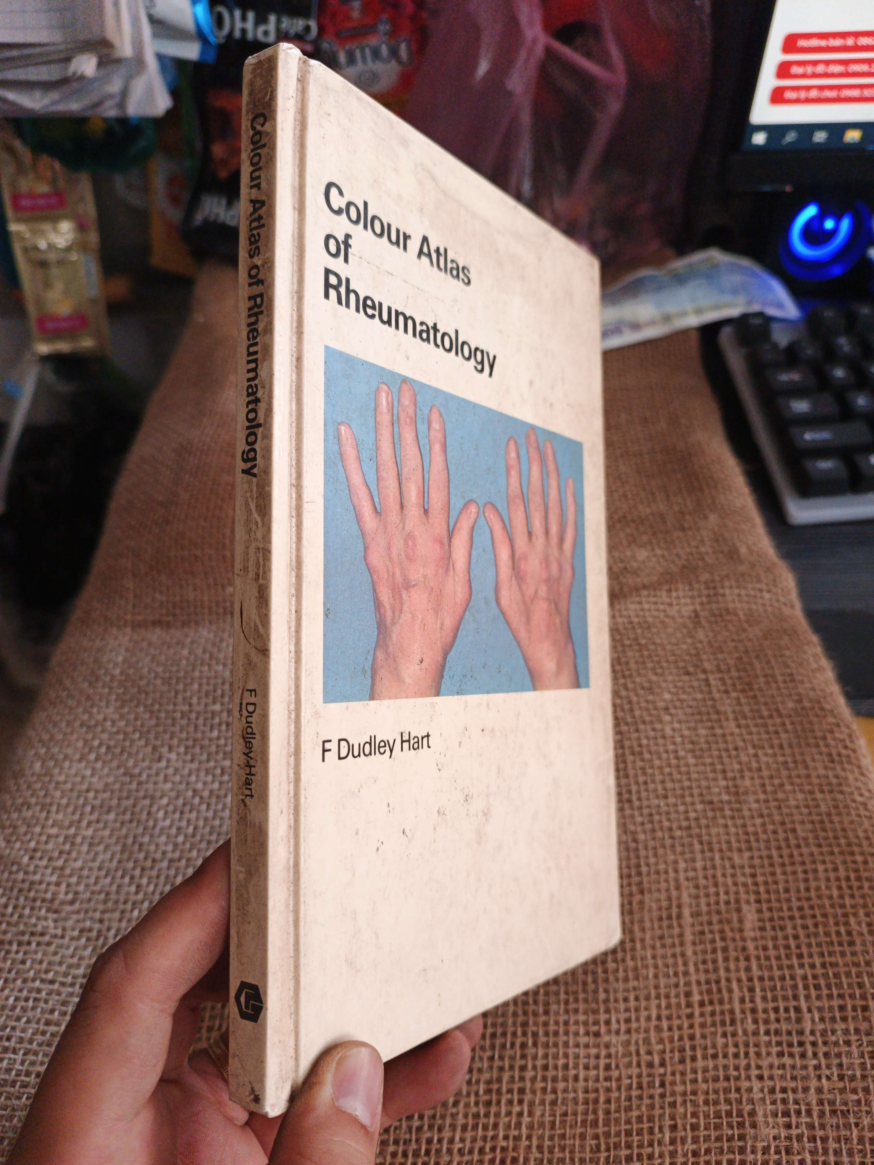 Color Atlas of Rheumatology - F.Dudley Hart mới 80% ố (Sách ngoại) HLSC060526