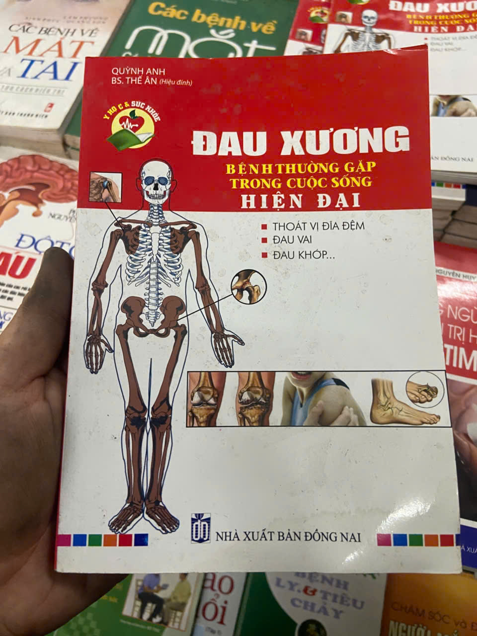 Đau xương: bệnh thường gặp trong cuộc sống hiện đại (Sách Y học - Sức khỏe - Thể thao) VAVO