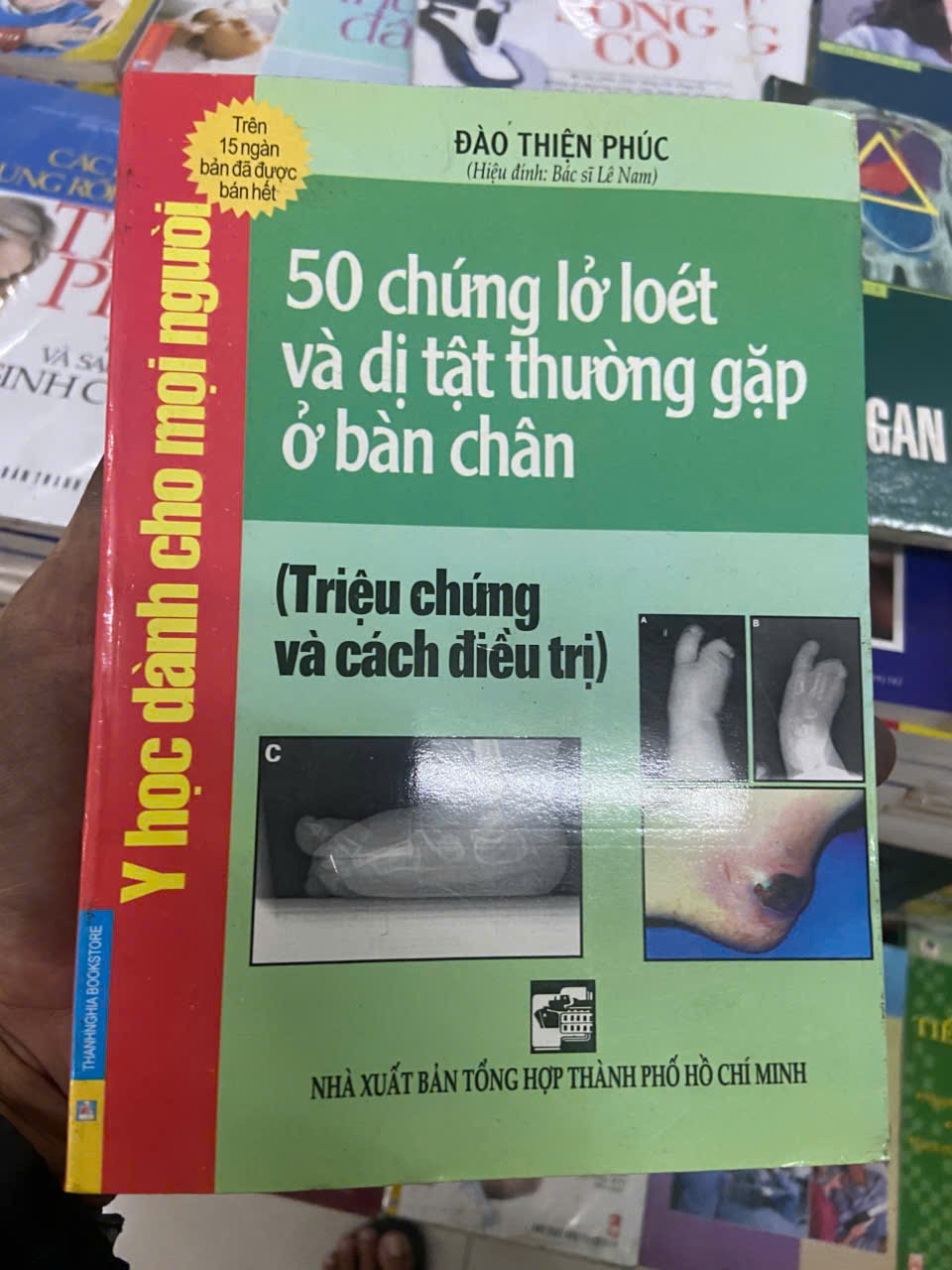 50 chứng lở loét và dị tật thường gặp ở bàn chân (Sách Y học - Sức khỏe - Thể thao) VAVO