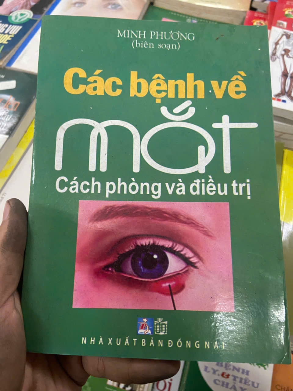 Các bệnh về mắt: cách phòng và điều trị (Sách Y học - Sức khỏe - Thể thao) VAVO